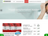 haartransplantationkosten.at Webseite Vorschau