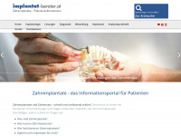 implantat-berater.at Webseite Vorschau