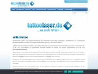 tattoolaser.de Webseite Vorschau