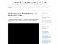 haartransplantation-tv-reportage.ch Webseite Vorschau