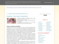 conjuntivite-alergica.blogspot.com