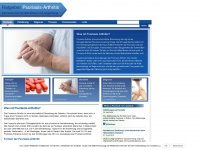 psoriasis-arthritis.org Webseite Vorschau