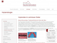 implantate-braunschweig.com Webseite Vorschau