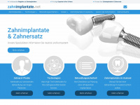 zahnimplantate.net Webseite Vorschau