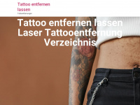 tattoo-entfernen-lassen.de Webseite Vorschau